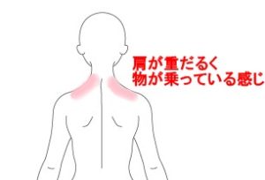 首や肩の痛み はりの症例 うめの手鍼灸院 うめの手鍼灸院 ー 子供からお年寄りまで安心 秦野市の鍼 はり 専門院