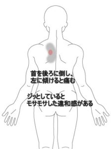 首 から 肩 にかけて の 痛み