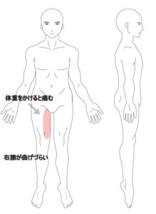 下肢 臀部の痛み うめの手鍼灸院 ー 子供からお年寄りまで安心 秦野市の鍼 はり 専門院