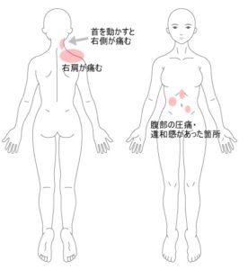 首や肩の痛み はりの症例 うめの手鍼灸院 うめの手鍼灸院 ー 子供からお年寄りまで安心 秦野市の鍼 はり 専門院