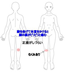 膝 の 裏側 痛み