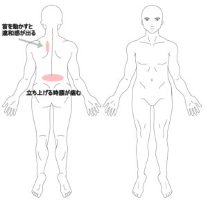 腰痛 ぎっくり腰 はりの症例 うめの手鍼灸院 うめの手鍼灸院 ー 子供からお年寄りまで安心 秦野市の鍼 はり 専門院