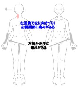 しびれ 腕 手 はりの症例 うめの手鍼灸院 うめの手鍼灸院 ー 子供からお年寄りまで安心 秦野市の鍼 はり 専門院