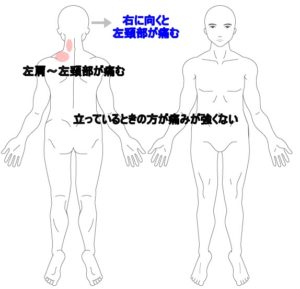 首や肩の痛み はりの症例 うめの手鍼灸院 うめの手鍼灸院 ー 子供からお年寄りまで安心 秦野市の鍼 はり 専門院