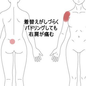 首や肩の痛み はりの症例 うめの手鍼灸院 うめの手鍼灸院 ー 子供からお年寄りまで安心 秦野市の鍼 はり 専門院