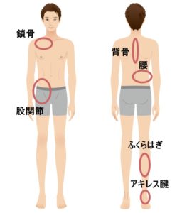 四十肩 五十肩 うめの手鍼灸院 ー 子供からお年寄りまで安心 秦野市の鍼 はり 専門院