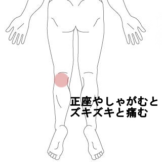 しゃがむと左膝の裏が痛む うめの手鍼灸院 ー 子供からお年寄りまで安心 秦野市の鍼 はり 専門院