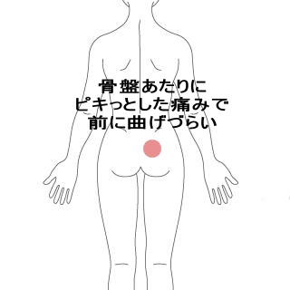 座りなおしたら腰にピキっと痛みが走った うめの手鍼灸院 ー 子供からお年寄りまで安心 秦野市の鍼 はり 専門院